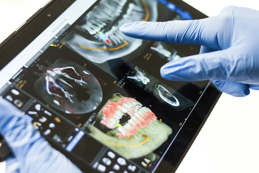 Main gantée qui montre un scan dentaire 3D sur une tablette